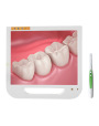 Best Intraoral Camera Dental Touch Screen Equipment